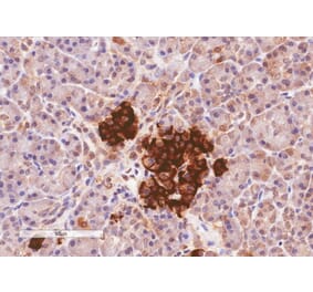 Immunohistochemistry - Anti-CCKAR Antibody (A84092) - Antibodies.com