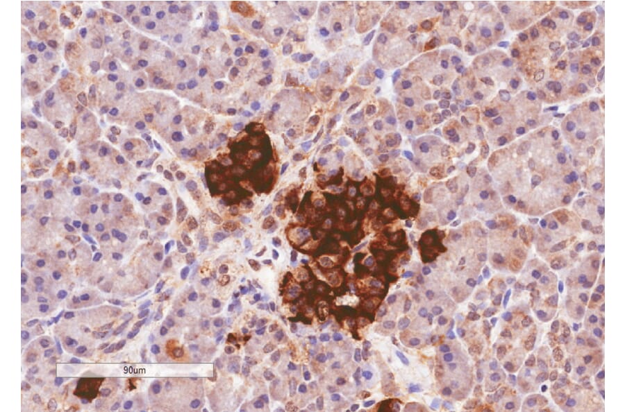 Immunohistochemistry - Anti-CCKAR Antibody (A84092) - Antibodies.com