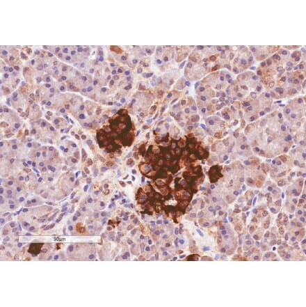 Immunohistochemistry - Anti-CCKAR Antibody (A84092) - Antibodies.com