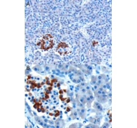 Immunohistochemistry - Anti-CCKAR Antibody (A84092) - Antibodies.com