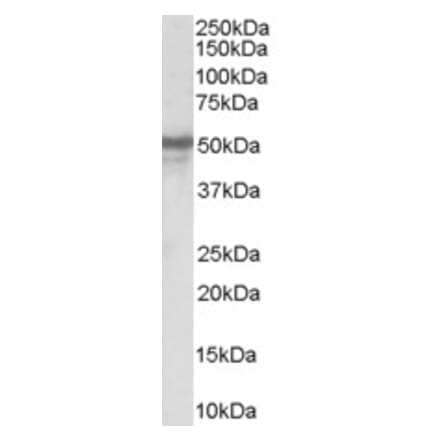 Western Blot - Anti-NPY5R Antibody (A84093)