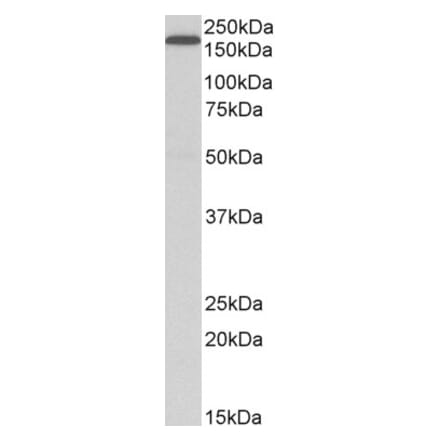 Western Blot - Anti-LRP5 Antibody (A84095) - Antibodies.com