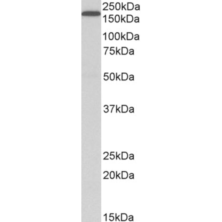 Western Blot - Anti-LRP5 Antibody (A84095) - Antibodies.com