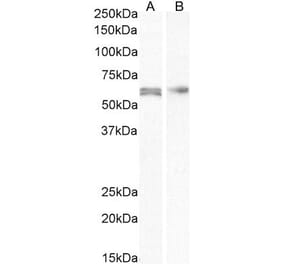 Western Blot - Anti-AKT2 Antibody (A84096) - Antibodies.com