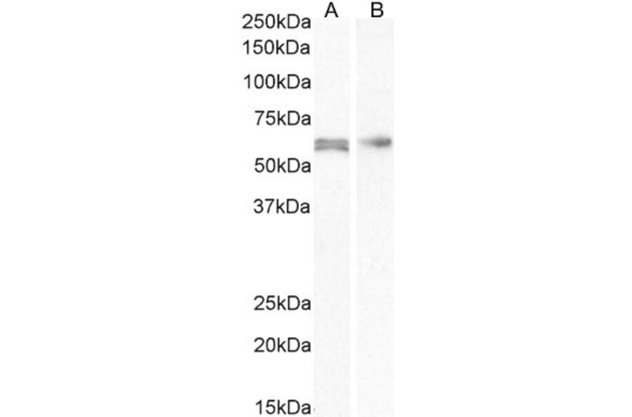 Western Blot - Anti-AKT2 Antibody (A84096) - Antibodies.com