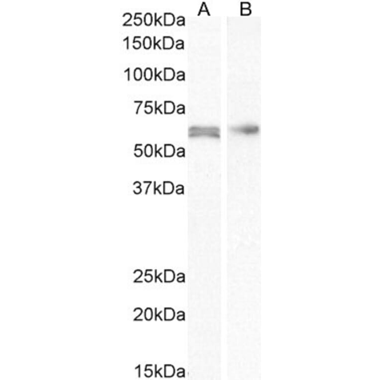 Western Blot - Anti-AKT2 Antibody (A84096) - Antibodies.com