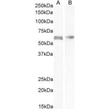 Western Blot - Anti-AKT2 Antibody (A84096) - Antibodies.com