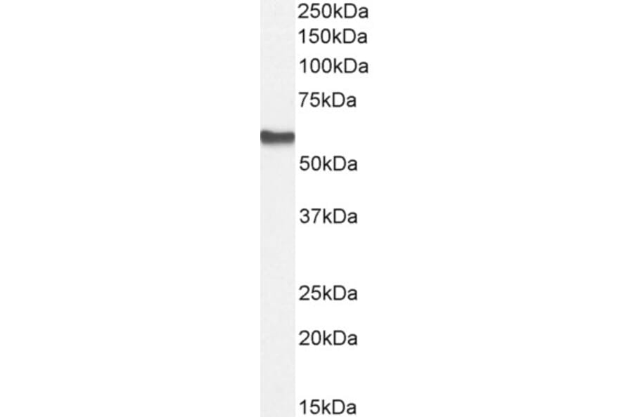 Western Blot - Anti-AKT2 Antibody (A84096) - Antibodies.com