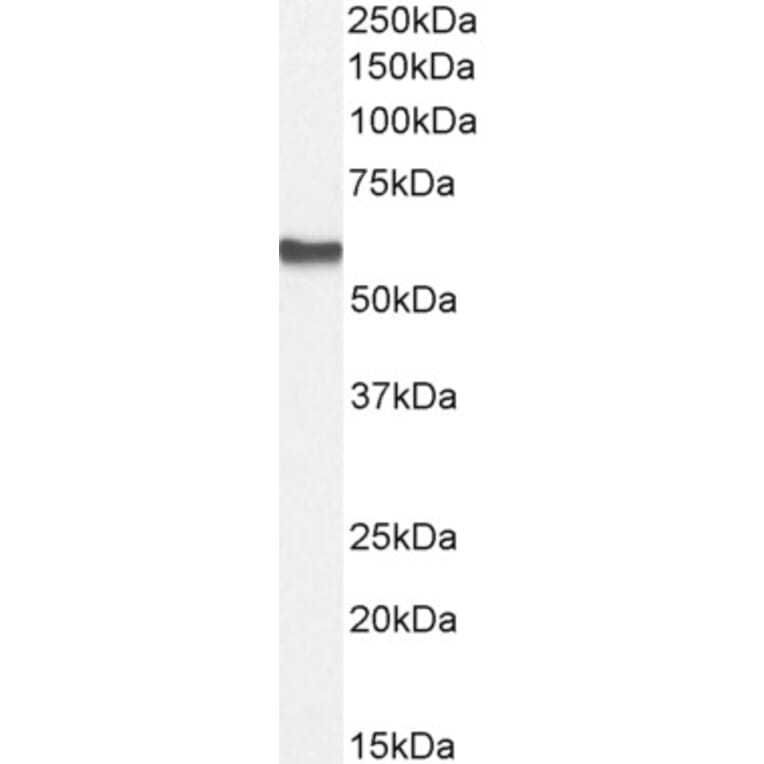 Western Blot - Anti-AKT2 Antibody (A84096) - Antibodies.com