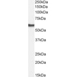 Western Blot - Anti-AKT2 Antibody (A84096) - Antibodies.com