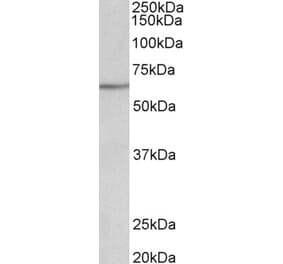 Western Blot - Anti-AKT2 Antibody (A84096) - Antibodies.com
