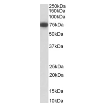 Western Blot - Anti-p75 NGF Receptor Antibody (A84097) - Antibodies.com