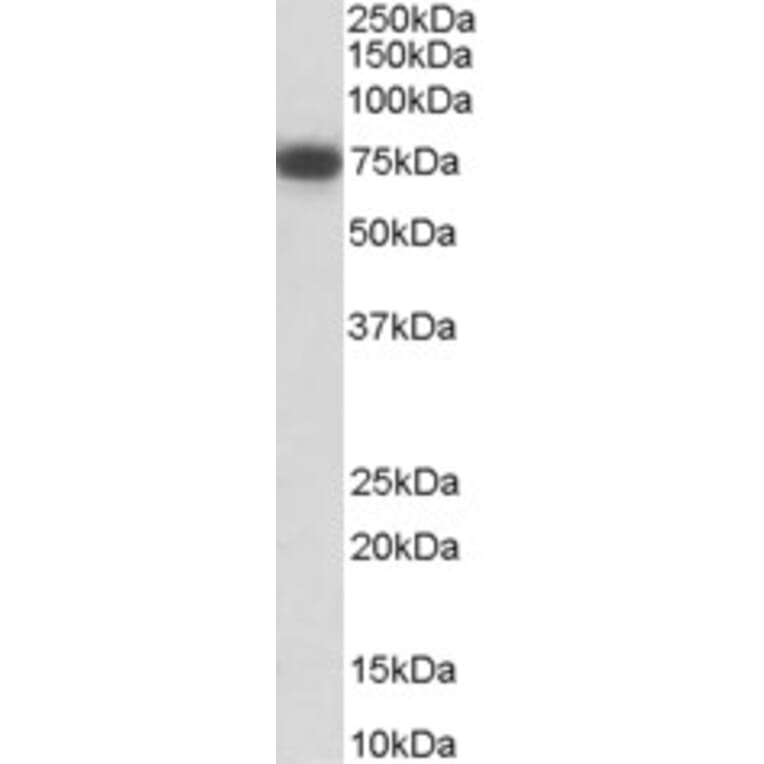 Western Blot - Anti-p75 NGF Receptor Antibody (A84097) - Antibodies.com