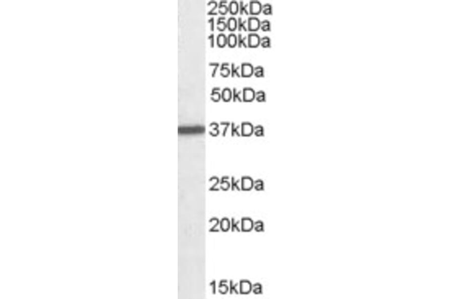 Western Blot - Anti-Liver Arginase Antibody (A84099) - Antibodies.com