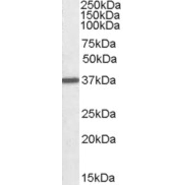 Western Blot - Anti-Liver Arginase Antibody (A84099) - Antibodies.com