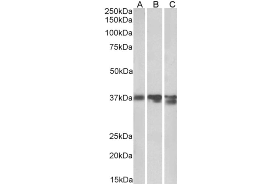 Western Blot - Anti-Liver Arginase Antibody (A84099) - Antibodies.com