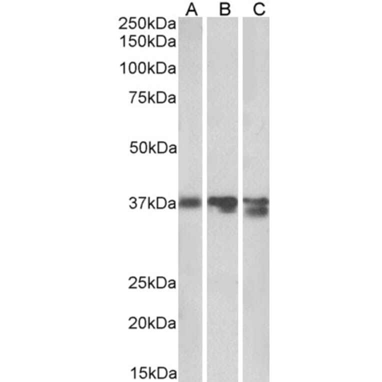 Western Blot - Anti-Liver Arginase Antibody (A84099) - Antibodies.com