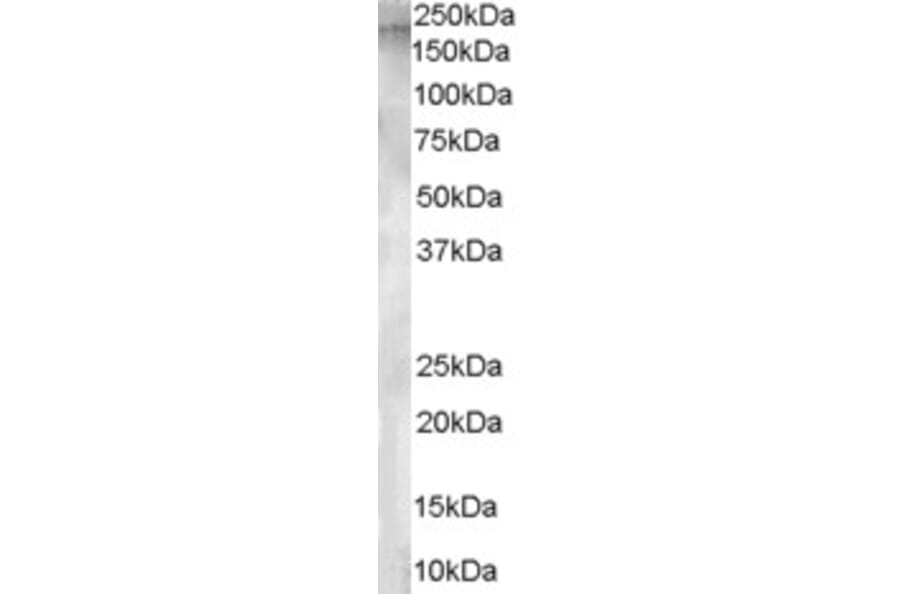 Western Blot - Anti-AP-A Antibody (A84100) - Antibodies.com