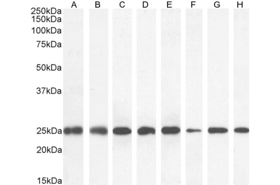 Western Blot - Anti-GST3/GST pi Antibody (A84101) - Antibodies.com