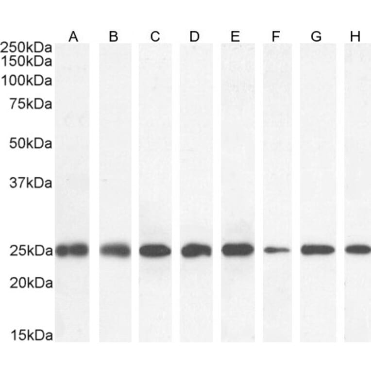 Western Blot - Anti-GST3/GST pi Antibody (A84101) - Antibodies.com