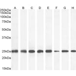 Western Blot - Anti-GST3/GST pi Antibody (A84101) - Antibodies.com