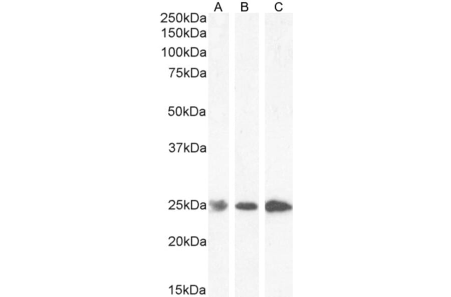 Western Blot - Anti-GST3/GST pi Antibody (A84101) - Antibodies.com