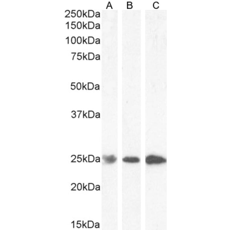 Western Blot - Anti-GST3/GST pi Antibody (A84101) - Antibodies.com