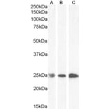 Western Blot - Anti-GST3/GST pi Antibody (A84101) - Antibodies.com