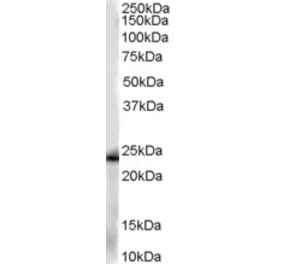 Western Blot - Anti-GSTP1 Antibody (A84101) - Antibodies.com