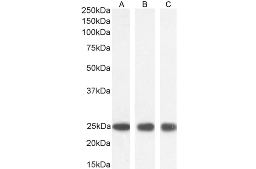 Western Blot - Anti-GST3/GST pi Antibody (A84101) - Antibodies.com