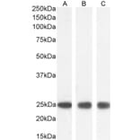 Western Blot - Anti-GST3/GST pi Antibody (A84101) - Antibodies.com