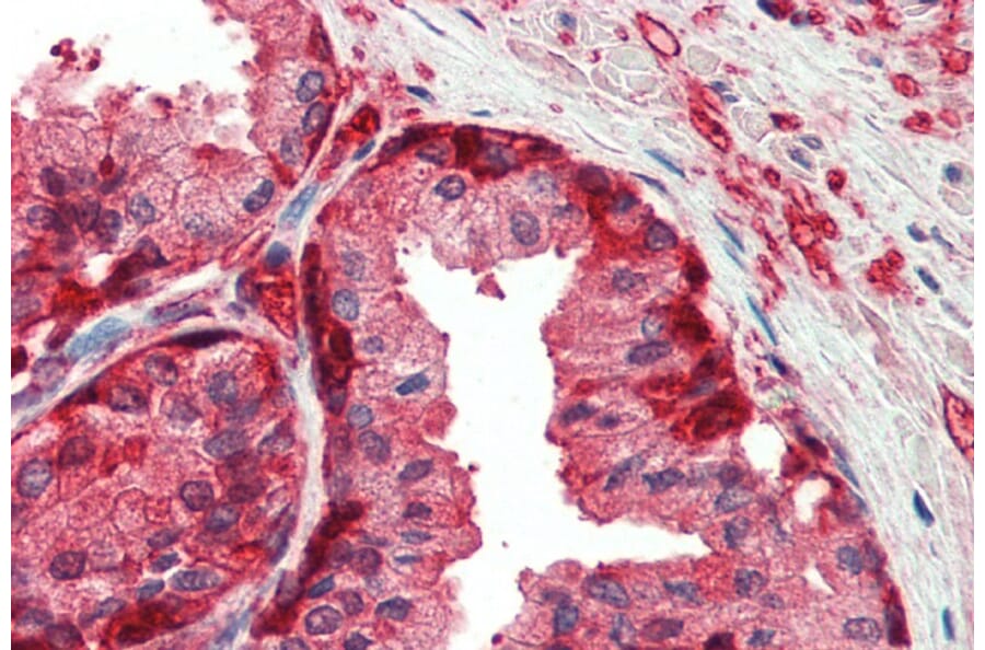 Immunohistochemistry - Anti-GST3/GST pi Antibody (A84101) - Antibodies.com