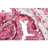 Immunohistochemistry - Anti-GST3/GST pi Antibody (A84101) - Antibodies.com