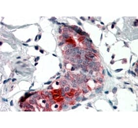 Immunohistochemistry - Anti-Mammaglobin A Antibody (A84103) - Antibodies.com