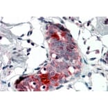 Immunohistochemistry - Anti-Mammaglobin A Antibody (A84103) - Antibodies.com