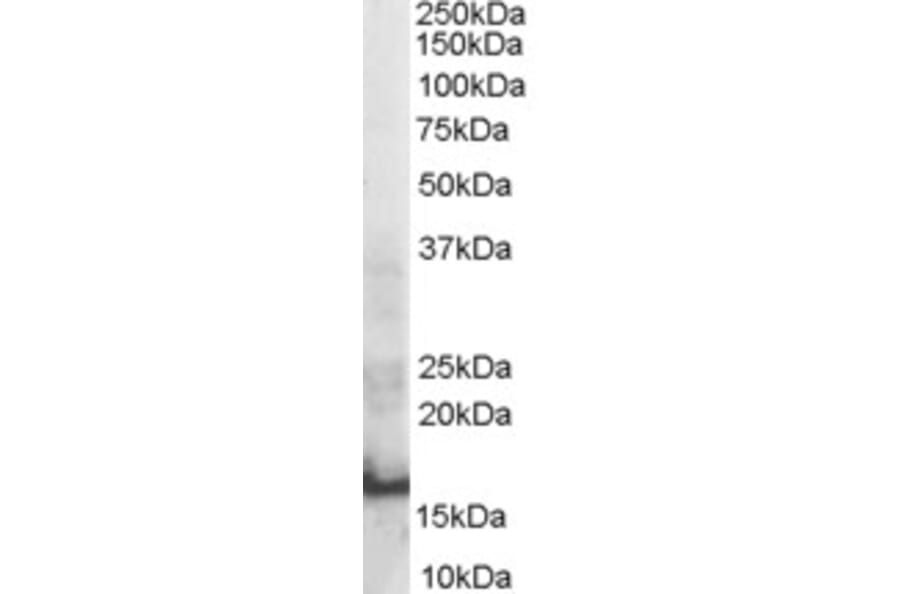 Western Blot - Anti-SH2D1A Antibody (A84106) - Antibodies.com