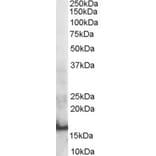 Western Blot - Anti-SH2D1A Antibody (A84106) - Antibodies.com