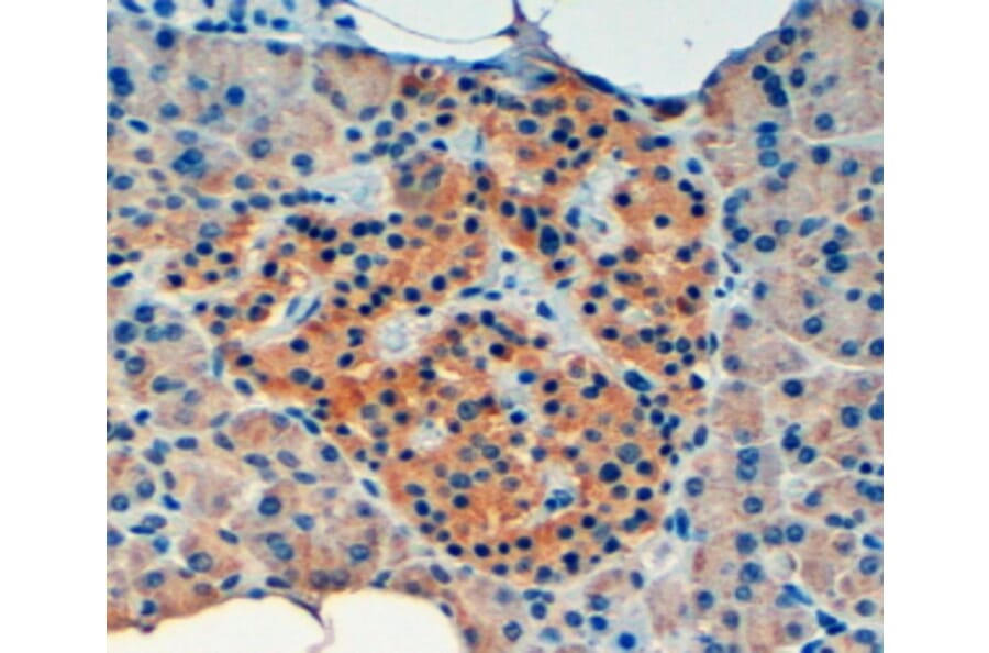 Immunohistochemistry - Anti-VPS11 Antibody (A84107) - Antibodies.com