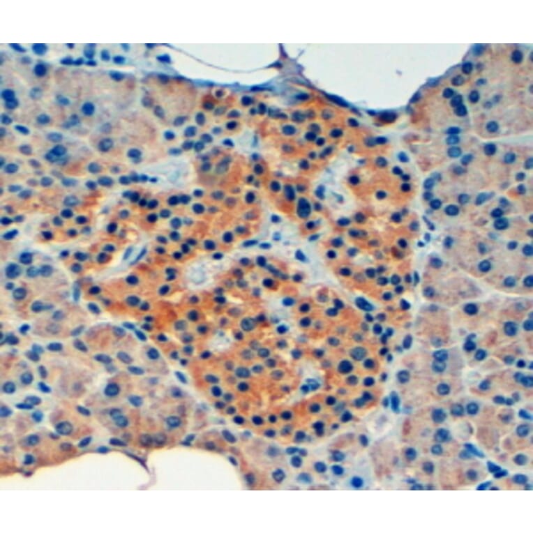 Immunohistochemistry - Anti-VPS11 Antibody (A84107) - Antibodies.com