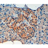 Immunohistochemistry - Anti-VPS11 Antibody (A84107) - Antibodies.com