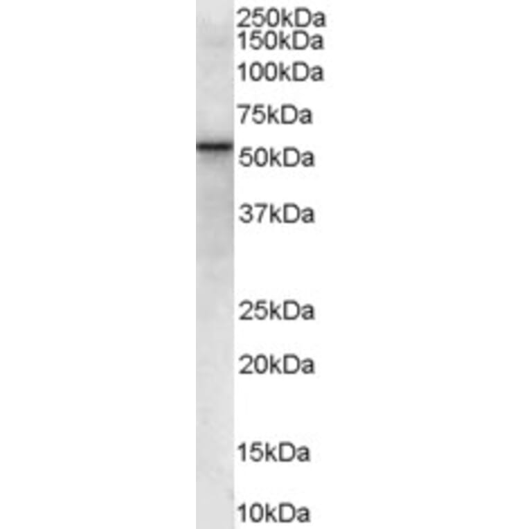 Western Blot - Anti-VPS45A (Internal) Antibody (A84108) - Antibodies.com