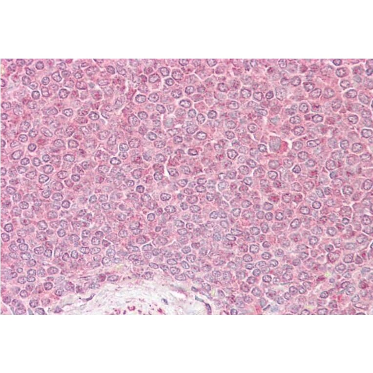 Immunohistochemistry - Anti-VPS45A (Internal) Antibody (A84108) - Antibodies.com