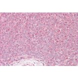 Immunohistochemistry - Anti-VPS45A (Internal) Antibody (A84108) - Antibodies.com