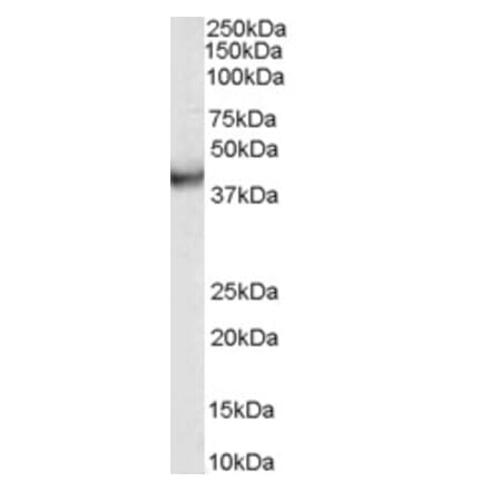 Western Blot - Anti-VPS37C Antibody (A84109) - Antibodies.com