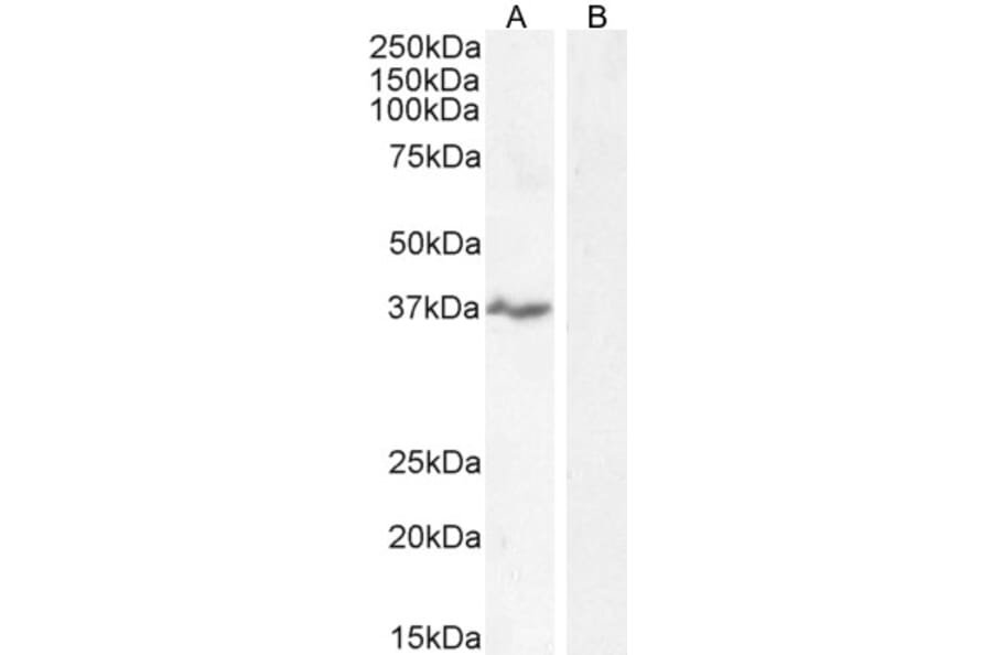 Western Blot - Anti-NKG2D Antibody (A84110) - Antibodies.com
