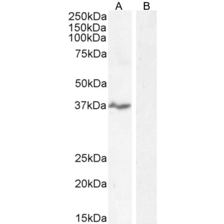 Western Blot - Anti-NKG2D Antibody (A84110) - Antibodies.com