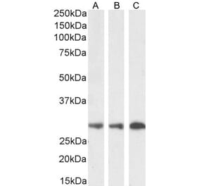 Western Blot - Anti-SDHB Antibody (A84115) - Antibodies.com