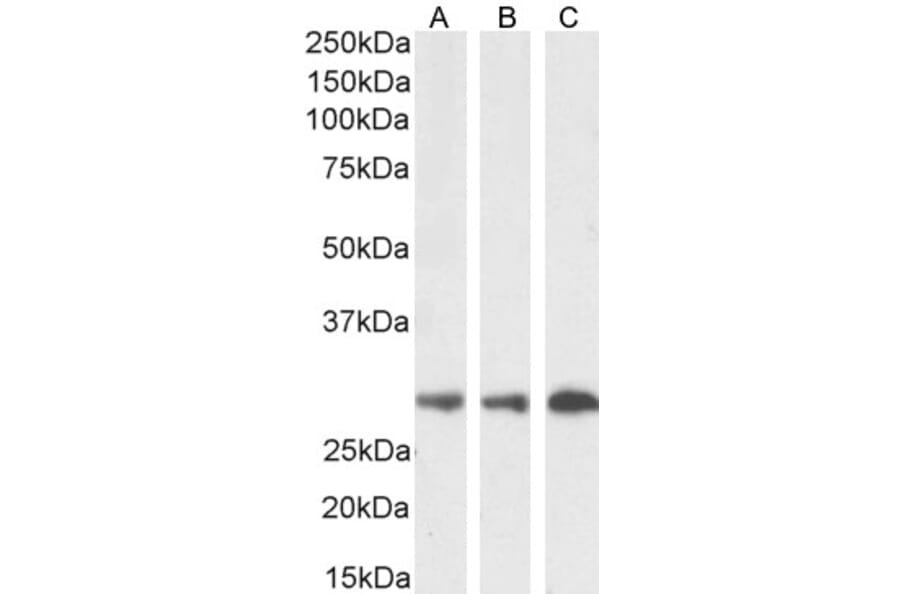 Western Blot - Anti-SDHB Antibody (A84115) - Antibodies.com
