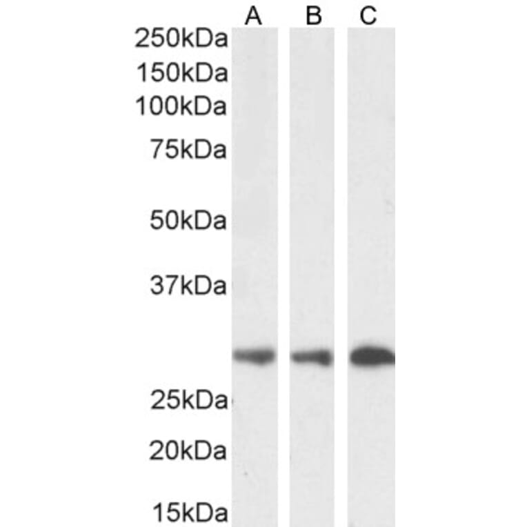 Western Blot - Anti-SDHB Antibody (A84115) - Antibodies.com