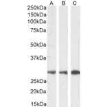 Western Blot - Anti-SDHB Antibody (A84115) - Antibodies.com